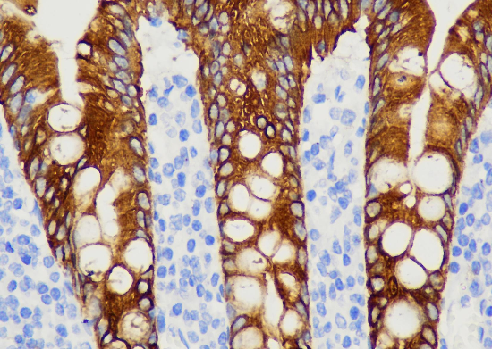 Immunochromogenic Reagent（HI）