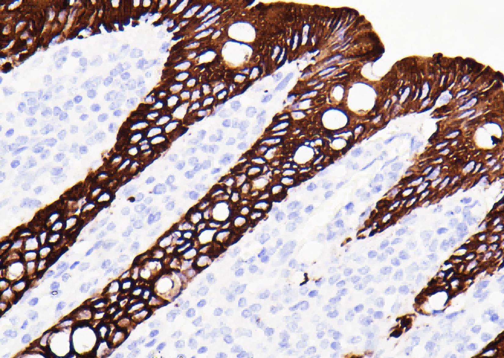 Immunochromogenic Reagent（EN）